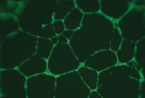 How to Choose Filter Plates for Automated Cell-based Assays: Biological and Hardware Considerations 