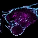 Morphodynamics of Human Early Brain Organoid Development