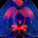 Automated Cell Counting and Pathology Mapping Across the Whole Brain
