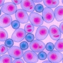 Unmasking Extramedullary Multiple Myeloma: Spatial Profiling of Plasma Cells