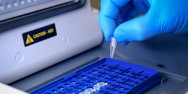 Hand holding a sample tube